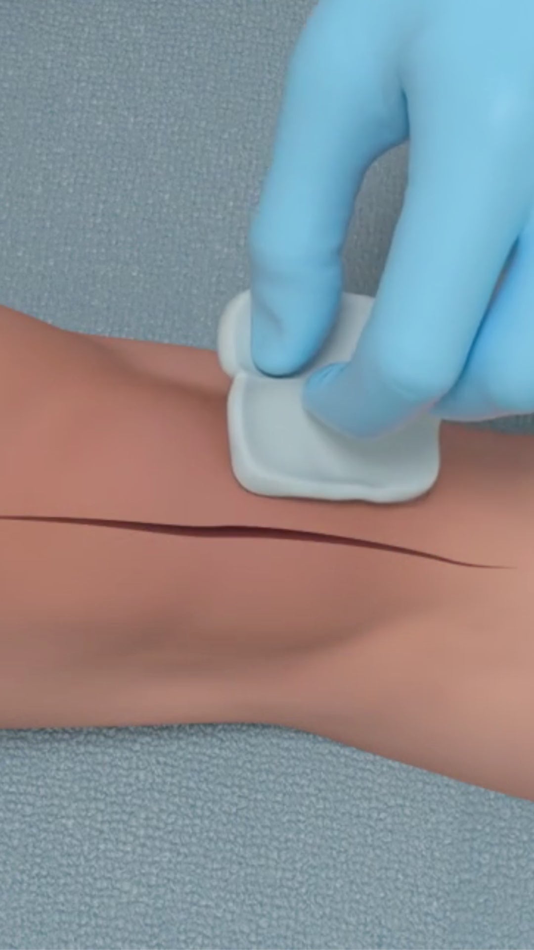 Load video: How to apply Brijjit Force Modulating Tissue Bridges